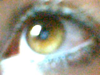 quel moche oeil